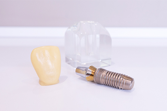 Implant dentar Timisoara